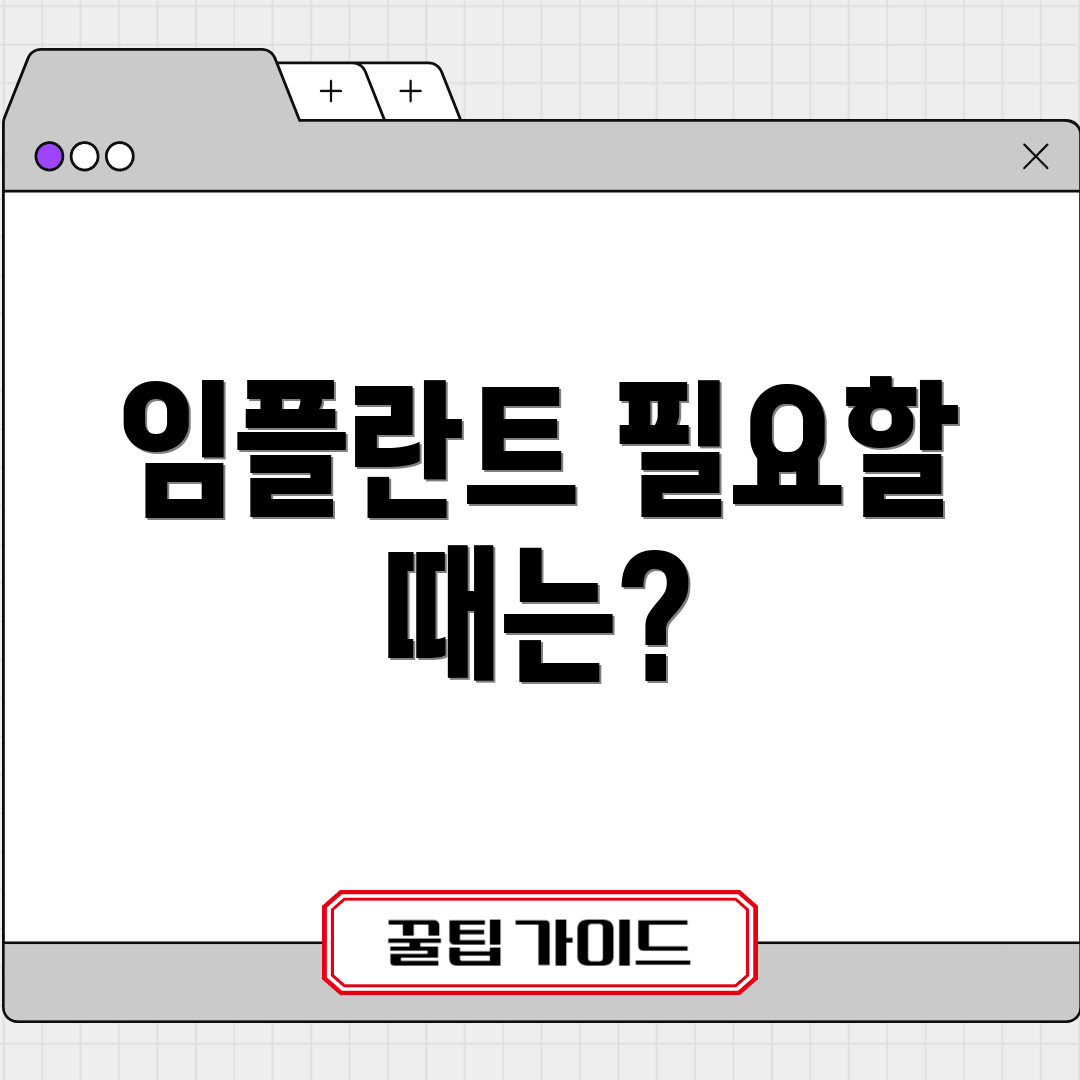 임플란트 필요할 때는?